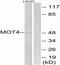 Solute Carrier Family 16 Member 3 antibody, A05510, Boster Biological Technology, Western Blot image 