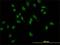 Lymphoid Enhancer Binding Factor 1 antibody, H00051176-M04, Novus Biologicals, Immunocytochemistry image 