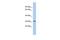 Calcium Voltage-Gated Channel Auxiliary Subunit Gamma 6 antibody, GTX47649, GeneTex, Western Blot image 