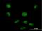 PHD Finger Protein 19 antibody, H00026147-B01P, Novus Biologicals, Immunocytochemistry image 