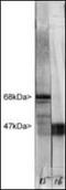 Neurofilament Light antibody, orb181509, Biorbyt, Western Blot image 