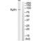 Terminal Uridylyl Transferase 1, U6 SnRNA-Specific antibody, PA5-50151, Invitrogen Antibodies, Western Blot image 