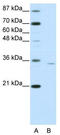 Orthopedia Homeobox antibody, TA345433, Origene, Western Blot image 