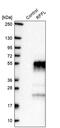 Ring Finger And FYVE Like Domain Containing E3 Ubiquitin Protein Ligase antibody, PA5-54003, Invitrogen Antibodies, Western Blot image 