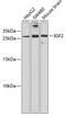 Insulin Like Growth Factor 2 antibody, A2086, ABclonal Technology, Western Blot image 