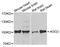 Argonaute RISC Catalytic Component 2 antibody, A6023, ABclonal Technology, Western Blot image 