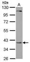 Phosphoribosyl Pyrophosphate Synthetase Associated Protein 2 antibody, GTX118643, GeneTex, Western Blot image 