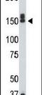 Death Associated Protein Kinase 1 antibody, PA5-14044, Invitrogen Antibodies, Western Blot image 