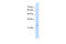 Cysteine Rich Hydrophobic Domain 1 antibody, 31-365, ProSci, Western Blot image 