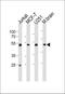 Enolase 1 antibody, MBS9212333, MyBioSource, Western Blot image 