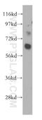 Leucine Rich Repeat Transmembrane Neuronal 1 antibody, 14288-1-AP, Proteintech Group, Western Blot image 
