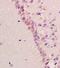 Amyloid Beta Precursor Protein Binding Family A Member 1 antibody, orb10085, Biorbyt, Immunohistochemistry paraffin image 