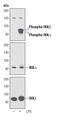 Inhibitor Of Nuclear Factor Kappa B Kinase Subunit Beta antibody, MA5-14857, Invitrogen Antibodies, Western Blot image 