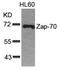 Zeta Chain Of T Cell Receptor Associated Protein Kinase 70 antibody, 79-348, ProSci, Western Blot image 