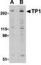 Telomerase Associated Protein 1 antibody, PA5-20354, Invitrogen Antibodies, Western Blot image 