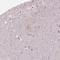 Inositol-Trisphosphate 3-Kinase A antibody, NBP1-81590, Novus Biologicals, Immunohistochemistry frozen image 