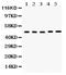 Vitamin D Receptor antibody, PB9456, Boster Biological Technology, Western Blot image 