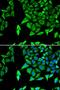 Natriuretic Peptide A antibody, LS-C331582, Lifespan Biosciences, Immunofluorescence image 
