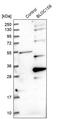 P2 antibody, PA5-58992, Invitrogen Antibodies, Western Blot image 