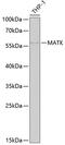 Megakaryocyte-Associated Tyrosine Kinase antibody, GTX64561, GeneTex, Western Blot image 