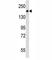 Platelet Derived Growth Factor Receptor Beta antibody, F40302-0.4ML, NSJ Bioreagents, Western Blot image 