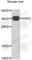 Arginase 1 antibody, A7520, ABclonal Technology, Western Blot image 