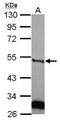 Plasminogen Activator, Urokinase antibody, PA5-34790, Invitrogen Antibodies, Western Blot image 