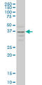 C-C Motif Chemokine Receptor 2 antibody, LS-C139073, Lifespan Biosciences, Western Blot image 