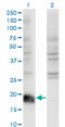 ADP Ribosylation Factor 6 antibody, LS-C196686, Lifespan Biosciences, Western Blot image 
