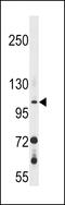 Guanylate Cyclase 2F, Retinal antibody, 58-840, ProSci, Western Blot image 