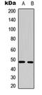 Solute Carrier Family 16 Member 14 antibody, orb315704, Biorbyt, Western Blot image 