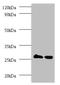 Thiopurine S-Methyltransferase antibody, A51617-100, Epigentek, Western Blot image 