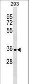 SIX2 antibody, LS-C158975, Lifespan Biosciences, Western Blot image 