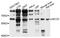 Beta,beta-carotene 9 ,10 -oxygenase antibody, STJ27039, St John
