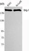 SWI/SNF Related, Matrix Associated, Actin Dependent Regulator Of Chromatin, Subfamily A, Member 4 antibody, STJ98473, St John