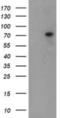 Tigger Transposable Element Derived 1 antibody, NBP2-03877, Novus Biologicals, Western Blot image 