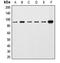 Catenin Beta 1 antibody, LS-C352117, Lifespan Biosciences, Western Blot image 