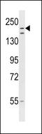 Listerin E3 Ubiquitin Protein Ligase 1 antibody, LS-C162650, Lifespan Biosciences, Western Blot image 