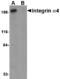 CD49D antibody, MBS150329, MyBioSource, Western Blot image 