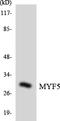 Myogenic Factor 5 antibody, LS-C200242, Lifespan Biosciences, Western Blot image 