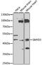 SET And MYND Domain Containing 3 antibody, 22-853, ProSci, Western Blot image 