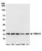 Transmembrane P24 Trafficking Protein 10 antibody, A305-227A, Bethyl Labs, Western Blot image 