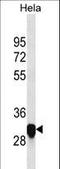 Proteolipid Protein 1 antibody, LS-C158820, Lifespan Biosciences, Western Blot image 