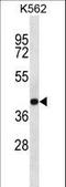 SEC14 Like Lipid Binding 4 antibody, LS-C158935, Lifespan Biosciences, Western Blot image 