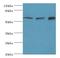 Translocase Of Outer Mitochondrial Membrane 70 antibody, LS-C376914, Lifespan Biosciences, Western Blot image 