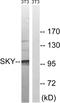 MER Proto-Oncogene, Tyrosine Kinase antibody, LS-C199253, Lifespan Biosciences, Western Blot image 
