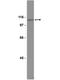 Protein Tyrosine Kinase 2 Beta antibody, NBP2-29897, Novus Biologicals, Western Blot image 