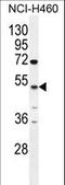 Carboxypeptidase A6 antibody, LS-C166984, Lifespan Biosciences, Western Blot image 