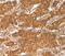 Component Of Inhibitor Of Nuclear Factor Kappa B Kinase Complex antibody, MBS2525657, MyBioSource, Immunohistochemistry frozen image 