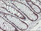 Solute Carrier Family 16 Member 1 antibody, LS-C172675, Lifespan Biosciences, Immunohistochemistry paraffin image 